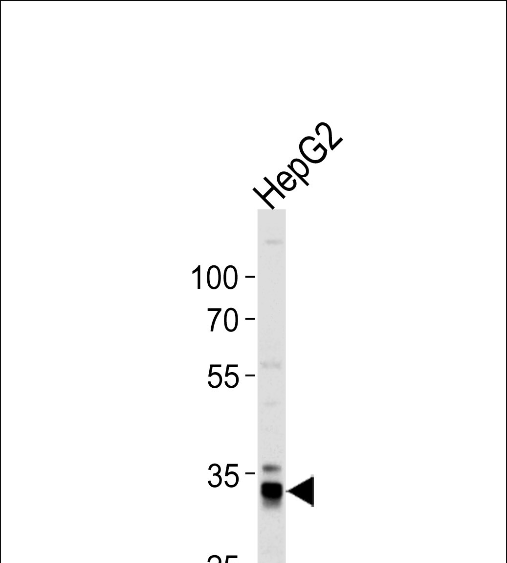 1 - MPST Antibody (N-term) AP7652a