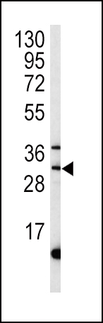 1 - MPST Antibody (C-term) AP7652b