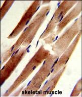 14 - ACTR2 Antibody (C-term) AP6533B