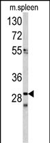 1 - CDCA3 Antibody (N-term) AP6614a