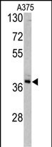 1 - TALDO1 Antibody (Center) AP6679c