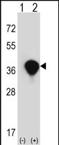 1 - TALDO1 Antibody (Center) AP6679c