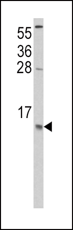 1 - CCL2 Antibody (C-term) AP6699B