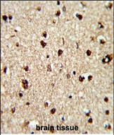 14 - TECPR1 Antibody (C-term) AP7391b
