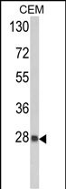 1 - PRDX6 Antibody (C-term) AP2927b