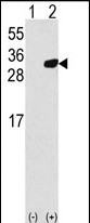 1 - PRDX6 Antibody (C-term) AP2927b