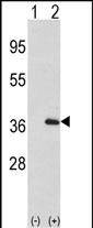 1 - IL1A-S87 Antibody AP6860a