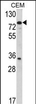 1 - TGM4 Antibody (Center) AP6918c