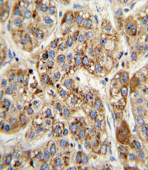 14 - MCCC2 Antibody (Center) AP6924c