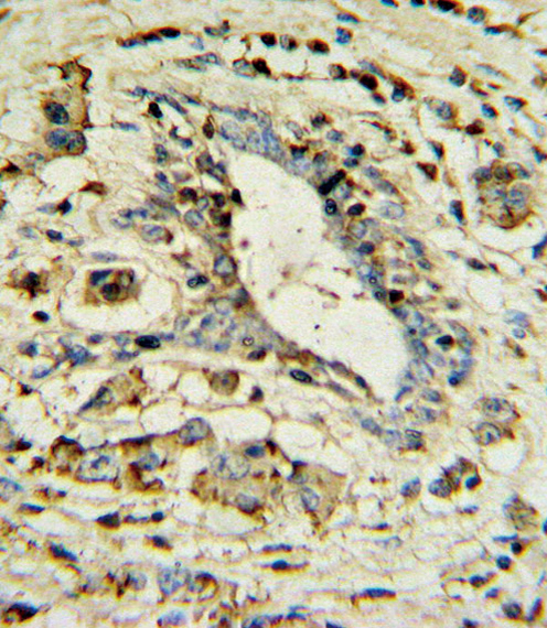 14 - APOL1 Antibody AP7361a