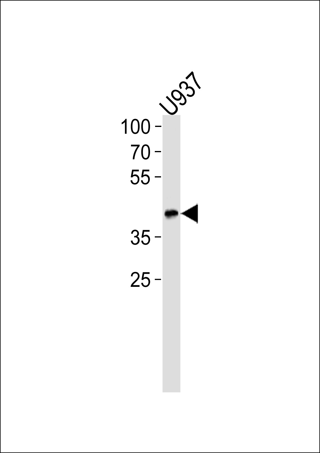 1 - APOL1 Antibody AP7361a