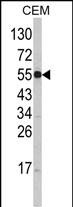 1 - SLC11A1 Antibody (Center) AP8514C