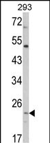1 - ATP5O Antibody (N-term) AP8563a