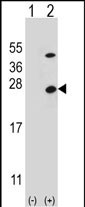1 - ATP5O Antibody (N-term) AP8563a
