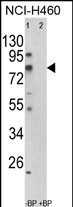 1 - ACSS3 Antibody (Center) AP8579c