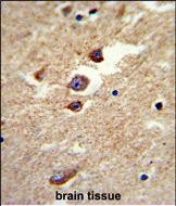 14 - ALDH5A1 Antibody AP1472d