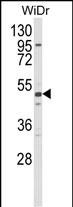 1 - ALDH5A1 Antibody AP1472d