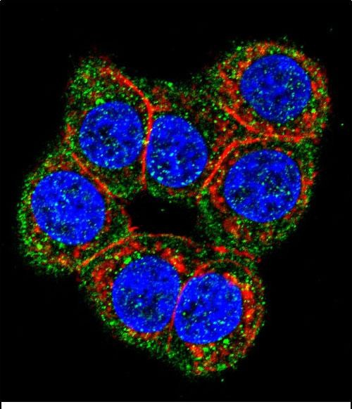 3 - CBS Antibody (N-term) AP6959A