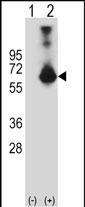 1 - CBS Antibody (N-term) AP6959A