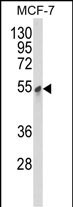 1 - PDK3 Antibody AP7040d