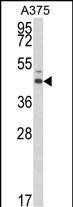 1 - ESRRA Antibody (Center) AP8635c
