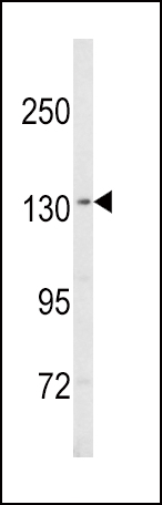 1 - SREBF1 Antibody (Center) AP8732c