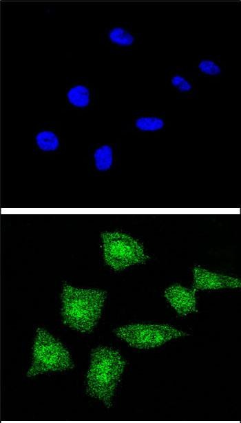 3 - SOD1 Antibody (Center) AP8733c