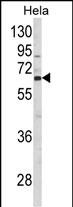1 - CTPS2 Antibody (N-term) AP8779a