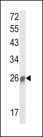 1 - SOCS1 Antibody (N-term) AP8790A