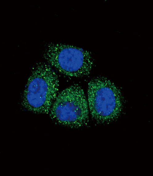 3 - SCNN1A Antibody (Center) AP8804C