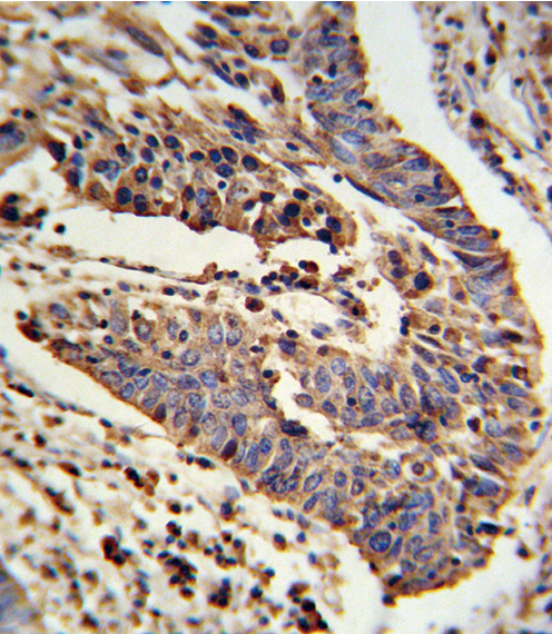 14 - SCNN1A Antibody (Center) AP8804C