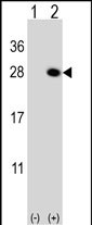 1 - QDPR Antibody (C-term) AP8841b