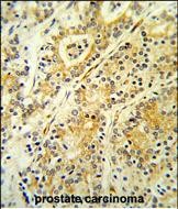 14 - MGST2 Antibody (C-term) AP8876b