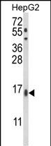 1 - MGST2 Antibody (C-term) AP8876b