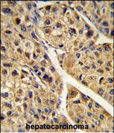 14 - PEX11A Antibody (N-term) AP9007a