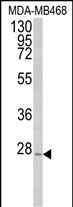 1 - PEX11A Antibody (N-term) AP9007a