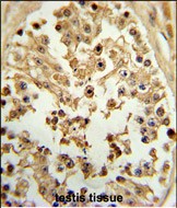 14 - EIF4E Antibody AP1954B