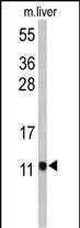1 - PCBD1 Antibody (Center) AP9111c