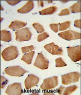 14 - PHYH Antibody (N-term) AP8711a