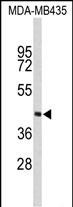 1 - PHYH Antibody (N-term) AP8711a