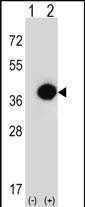 1 - PHYH Antibody (N-term) AP8711a