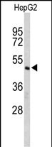 1 - CFLAR Antibody (Center) AP9123c