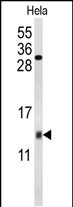 1 - COX5A Antibody (Center) AP9154c