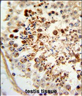 14 - COX6A1 Antibody (Center) AP9155c