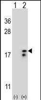 1 - COX6A1 Antibody (Center) AP9155c