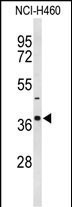 1 - SLC25A17 Antibody (N-term) AP9172a
