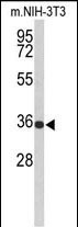 1 - SLC25A17 Antibody (N-term) AP9172a