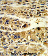 14 - ADH6 Antibody (Center) AP9203c