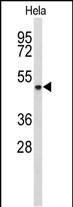 1 - ADH6 Antibody (Center) AP9203c