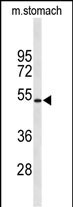 1 - KCNJ11 Antibody (N-term) AP9209a